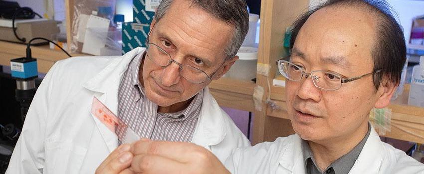 Dr. Mike Lin, left, and Dr. Ron Balczon work in Dr. Lin's lab at the USA College of Medicine. They are conducting research into a possible link between hospital-acquired bacterial pneumonia and cognitive impairment.  
